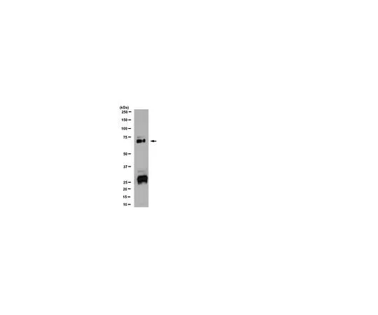 62-8455-91 Anti- Vitamin K dependent protein S; 100 μg AB15928