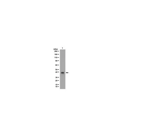 62-8390-05 Anti-HDAC11; 100 μg 09-827