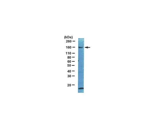 62-8381-22 Anti-IRS1; 100 μg 06-248
