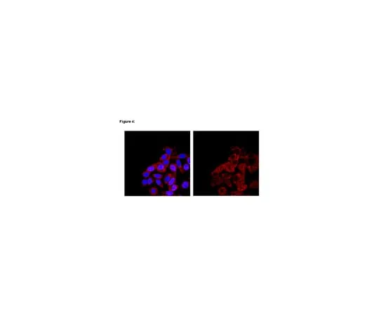 62-8367-51 RIPAb+(TM) SMN; 10 assays 03-178
