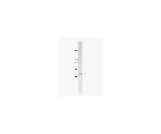 62-8371-88 Anti-PP2A, B subunit, clone 2G9; 200 μL 05-592