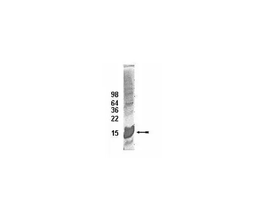 62-8391-67 UbcH5c Conjugating Enzyme; 100 μg 14-811