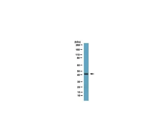62-8388-38 Anti-Septin-2; 100 μL 07-1813