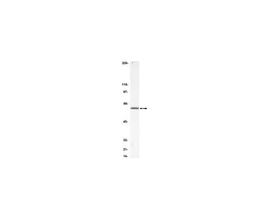 62-8382-17 Anti-FLIP, CT; 200 μg 06-864