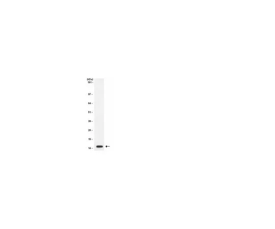 62-8368-96 Anti-Histone H3, CT, pan, clone A3S; 100 μL 04-928