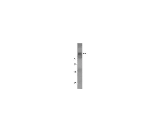 62-8384-13 Anti-TrkC; 200 μg 07-226
