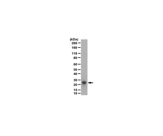 62-8445-67 Anti-Protein Gene Product 9.5 Antibody Cat. No. AB1761-I AB1761-I