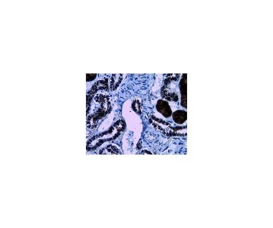 62-8388-93 Anti-WNK4; 100 μg 7-70