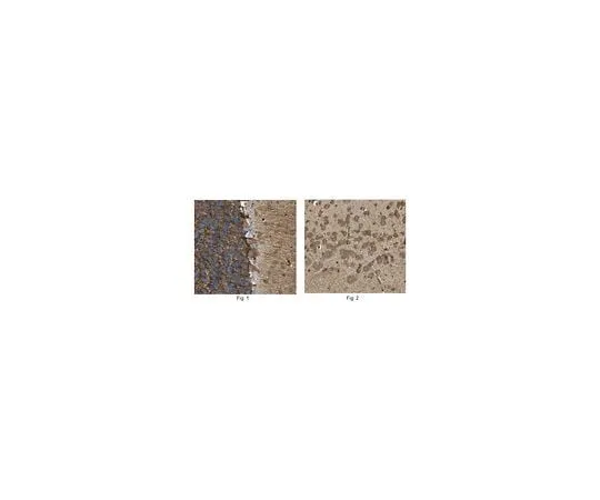 62-8455-58 Anti-Tryptophan hydroxylase 1/TPH1 AB15570-I
