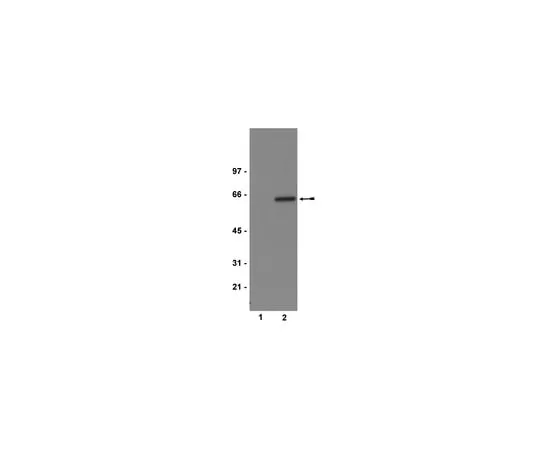 62-8372-37 Anti-phospho-Akt1/PKBα (Ser473), clone 11E6; 100 μg 05-669