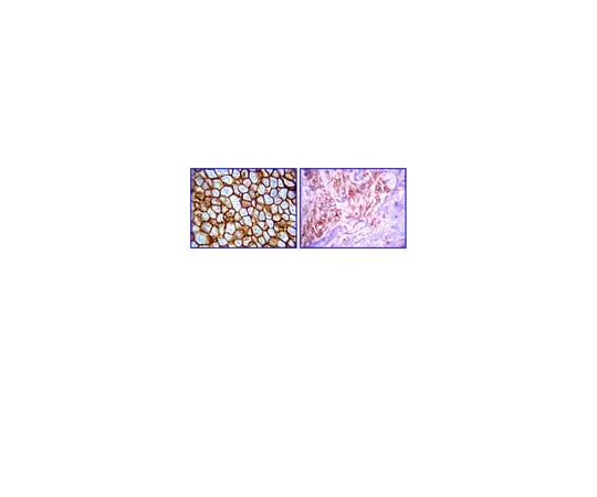 62-8374-31 Anti-c-erbB-4, clone HFR1/2G4; 100 μg 05-1133