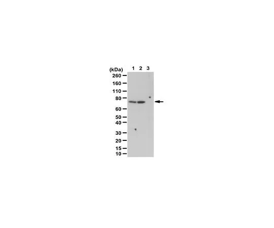 62-8383-52 Anti-phospho-p70 S6 Kinase (Thr389) 07-018-I
