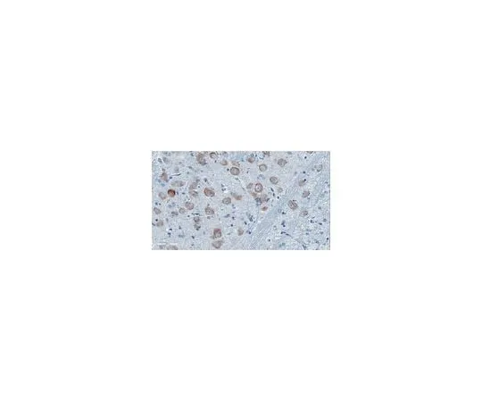 62-8468-12 Anti-ApoE4 Fragment nApoECF Antibody (Asp172) ABN1350
