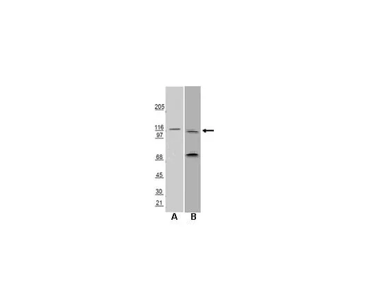 62-8453-84 Anti-Huntingtin-Interacting Protein 1 Related (HIP1R); 100 μL AB9882