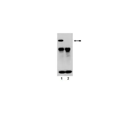 62-8386-62 Anti-phospho-PKCα (Ser657/Tyr658); 100 μL 07-790