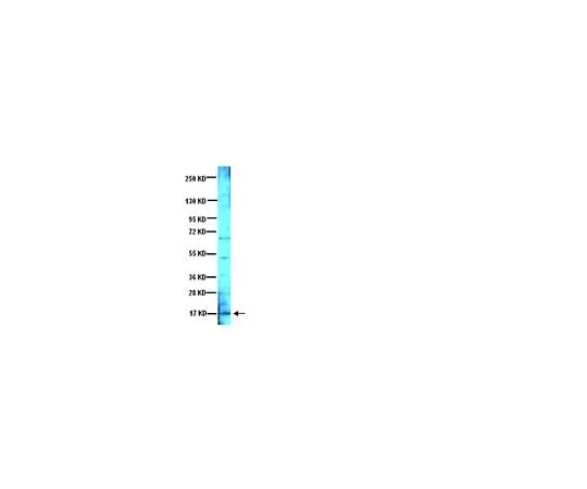 62-8445-14 Anti-Brain Derived Neurotrophic Factor; 500 μg AB1534SP