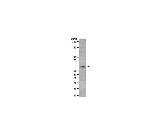 62-8368-50 Anti-Akt2/PKBβ, clone AW114; 100 μl 04-771