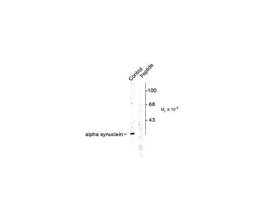 62-8453-72 Anti-phospho-Alpha Synuclein (Ser129); 100 μL AB9850