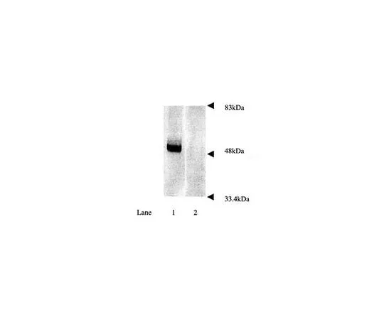 62-8449-16 Anti-Parkin, a.a. 305-323; 50 μL AB5112