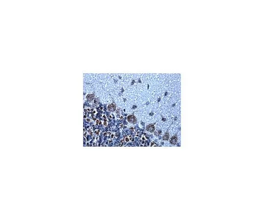 62-8453-78 Anti-NMDAR1, clone 1.17.2.6; 100 μL AB9864R