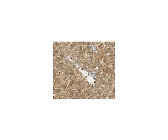 62-8458-14 Anti-FABP1 ABC430