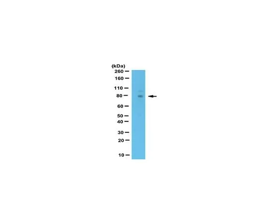 62-8461-80 Anti-WAC, C-terminus, Cat. No. ABE471 ABE471