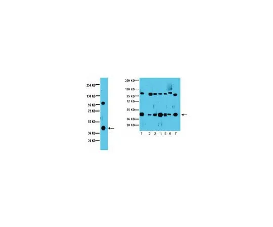 62-8387-16 Anti-Gβ5; 100 μg 07-1208