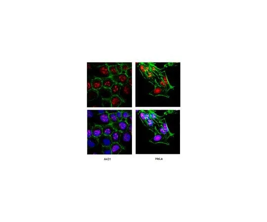 62-8452-83 Anti-Ki-67; 500 μL AB9260