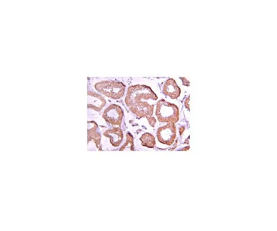 62-8387-23 Anti- Protein Phosphatase 2 C α/β; 100 μg 07-1223