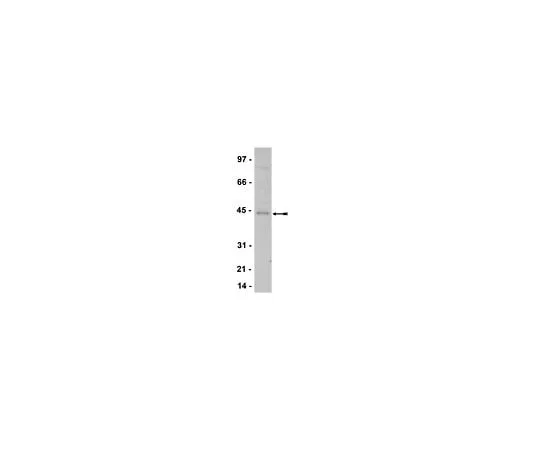 62-8385-87 Anti-TTF-1; 200 μL 07-601