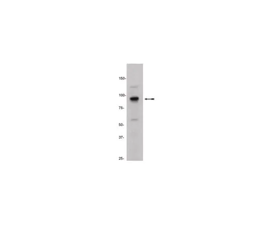 62-8367-88 Anti-SUZ12, clone 3C1.2; 100 μg 04-046