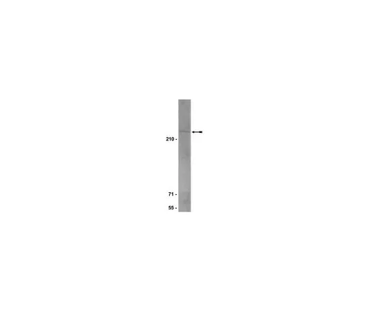 62-8372-35 Anti-BRCA2, clone 5.23; 200 μg 05-666