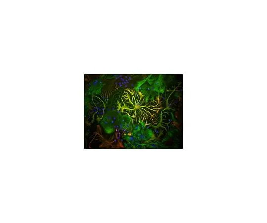 62-8450-51 Anti-Glial Fibrillary Acidic Protein; 50 μL AB5541