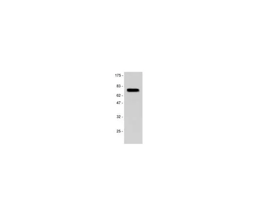 62-8385-34 Anti-p75NTR (Neurotrophin Receptor); 100 μg 07-476