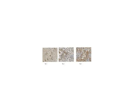 62-8444-66 Anti-Neuron Specific Enolase Antibody Cat. No. AB951-I AB951-I