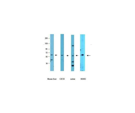 62-8382-07 Anti-Frizzled 5; 200 μg 06-756