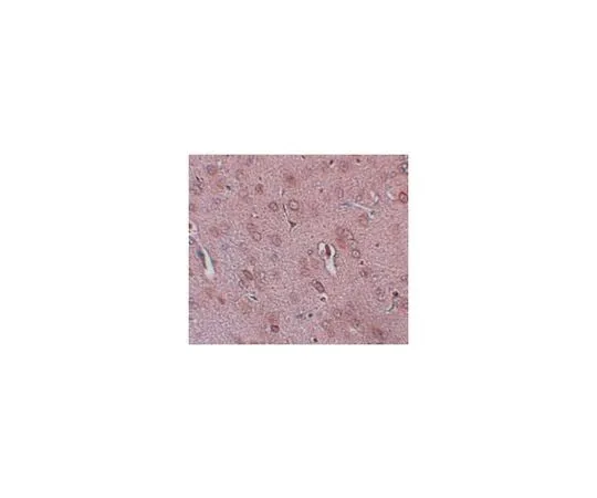 62-8467-81 Anti-TRESK ABN648