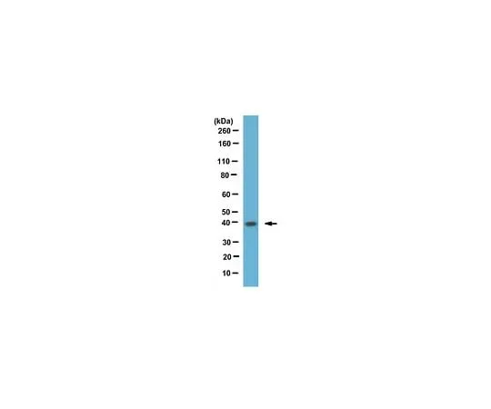 62-8463-31 Anti-phospho Cyclin-dep***ent kinase 7 (Thr170) ABE1317 ABE1317
