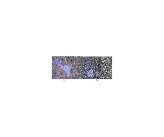 62-8383-02 Anti-Interleukin-18 (IL-18); 100 μg 06-1115