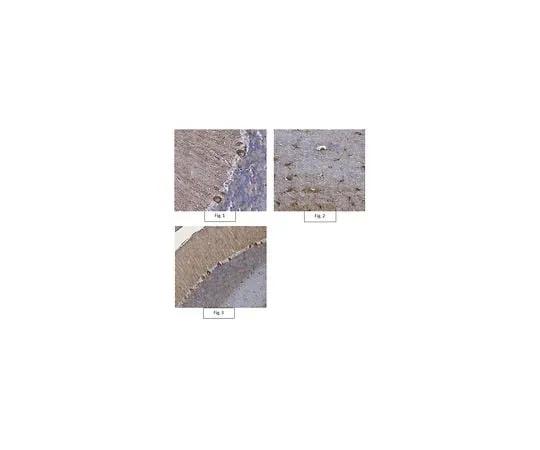 62-8468-11 Anti-Septin 11 Antibody ABN1342