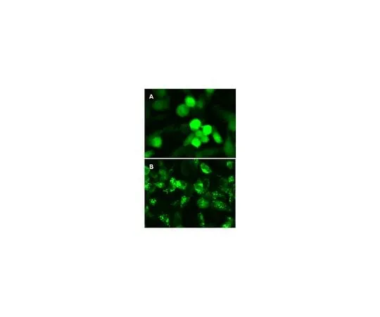 62-8394-43 LentiBrite(TM) GFP-LC3 Lentiviral Biosensor 17-10193