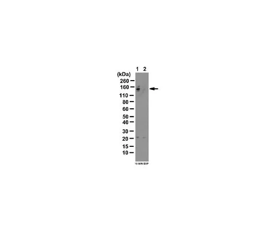 62-8388-92 Anti-phospho-TBC1D1 (Ser237); 100 μg 7-68