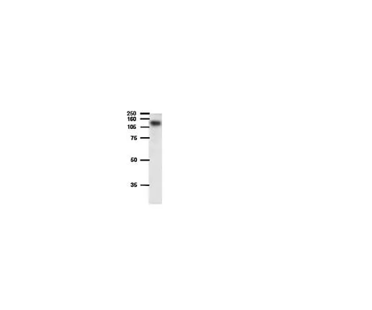 62-8454-30 Anti-ATP-binding cassette, sub-family B (MDR/TAP), member 1A; 50 μL AB10340