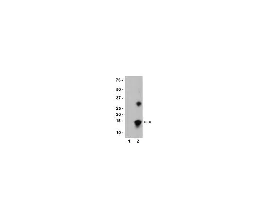 62-8396-19 Anti-nitro-α/β-Synuclein (Tyr39), clone nSyn14; 200 μL 36-012