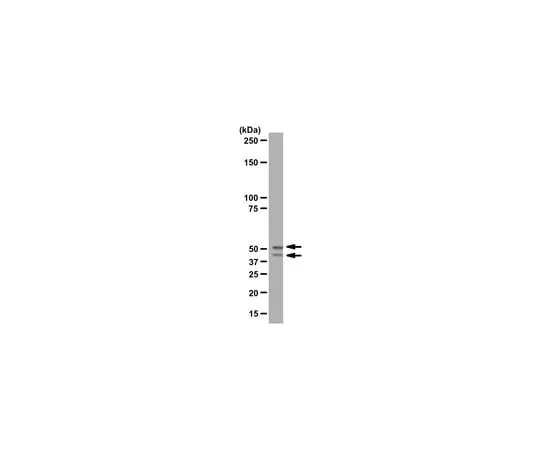62-8368-93 Anti-GSK3α/β; 100 μL 04-903