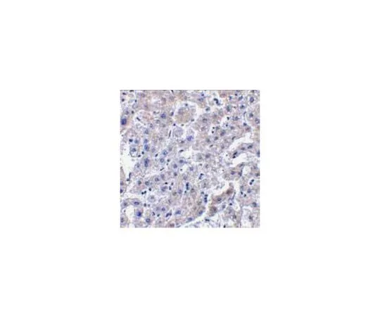 62-8458-88 Anti-Caspase-14 ABC841