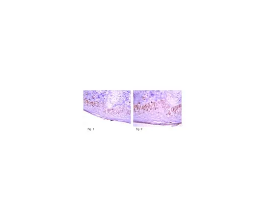62-8374-27 Anti-Harmartin (TSC1); 100 μL 05-1113