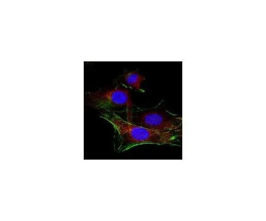 62-8381-45 Anti-PDGFR Beta Antibody 06-498-I