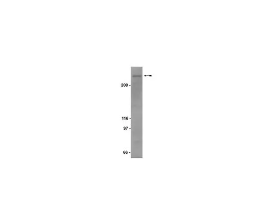 62-8382-26 Anti-SMRTe; 200 μg 06-891