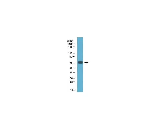 62-8383-37 Anti-SRp75; 100 μL 06-1367